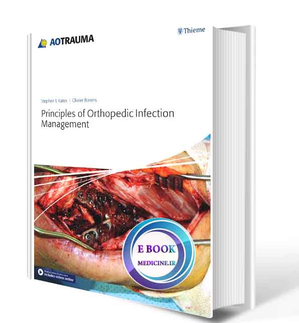 دانلود کتابPrinciples of Orthopedic Infection Management 1st Edition2017( PDF)